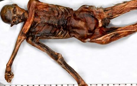 Mumi berusia 5.300 tahun bernama Otzi, Fakta Yang Mengejutkan