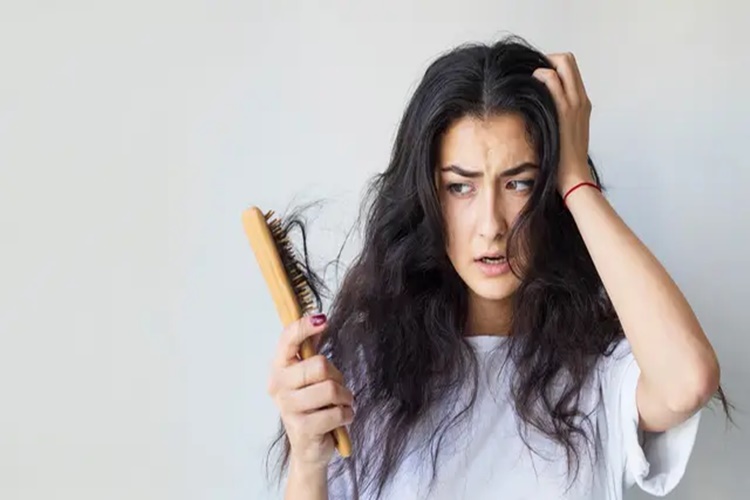 6 Cara Mengatasi Rambut Rontok di Usia Muda